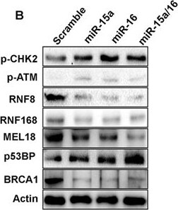 RNF168 Antibody - BSA Free
