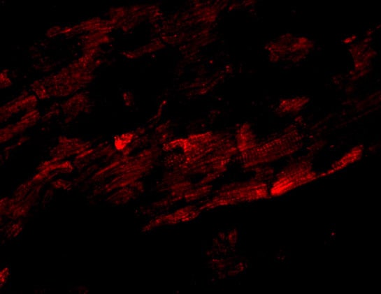 ZFYVE26 Antibody - BSA Free