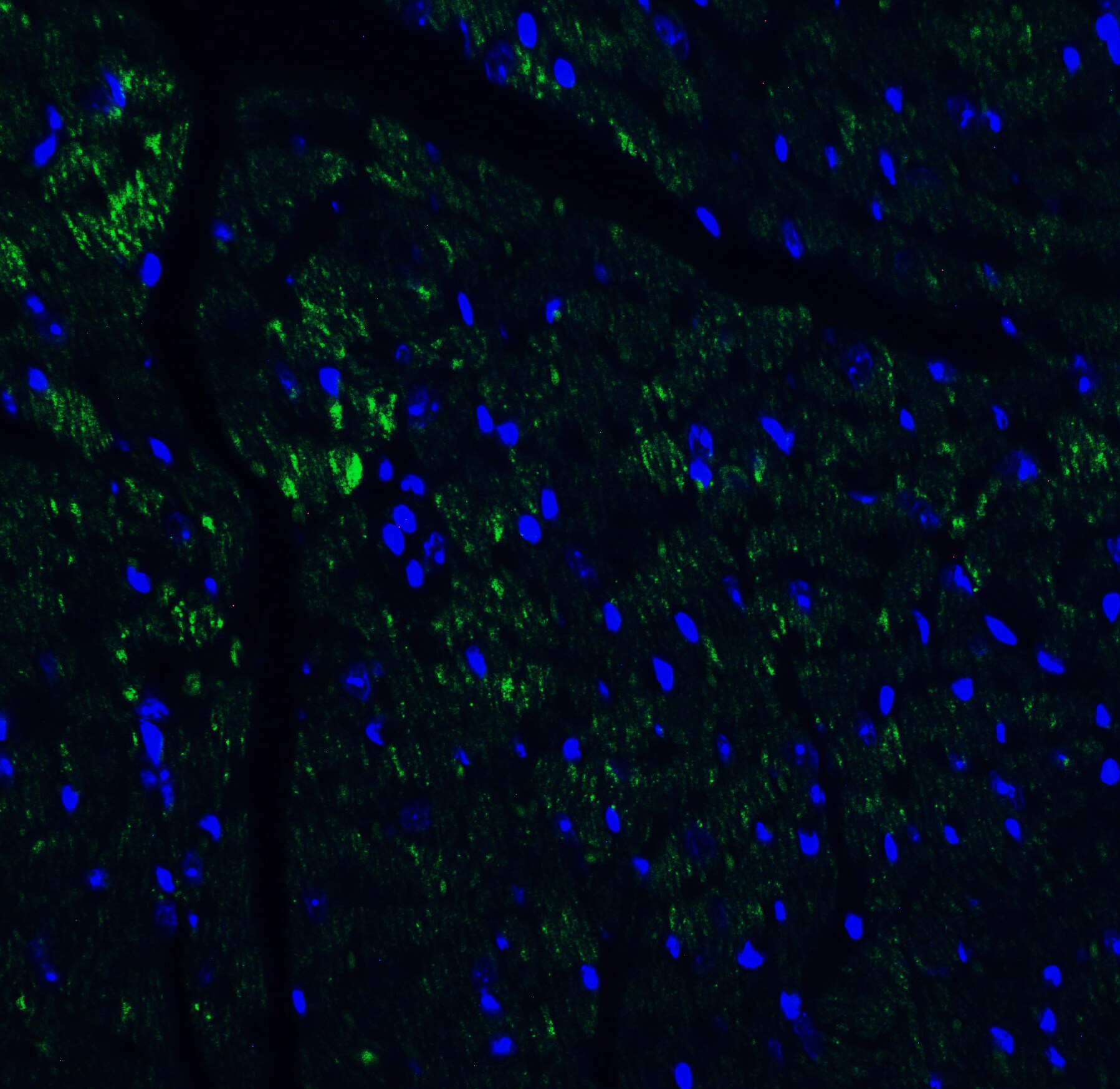 IL-17/IL-17A Antibody - BSA Free