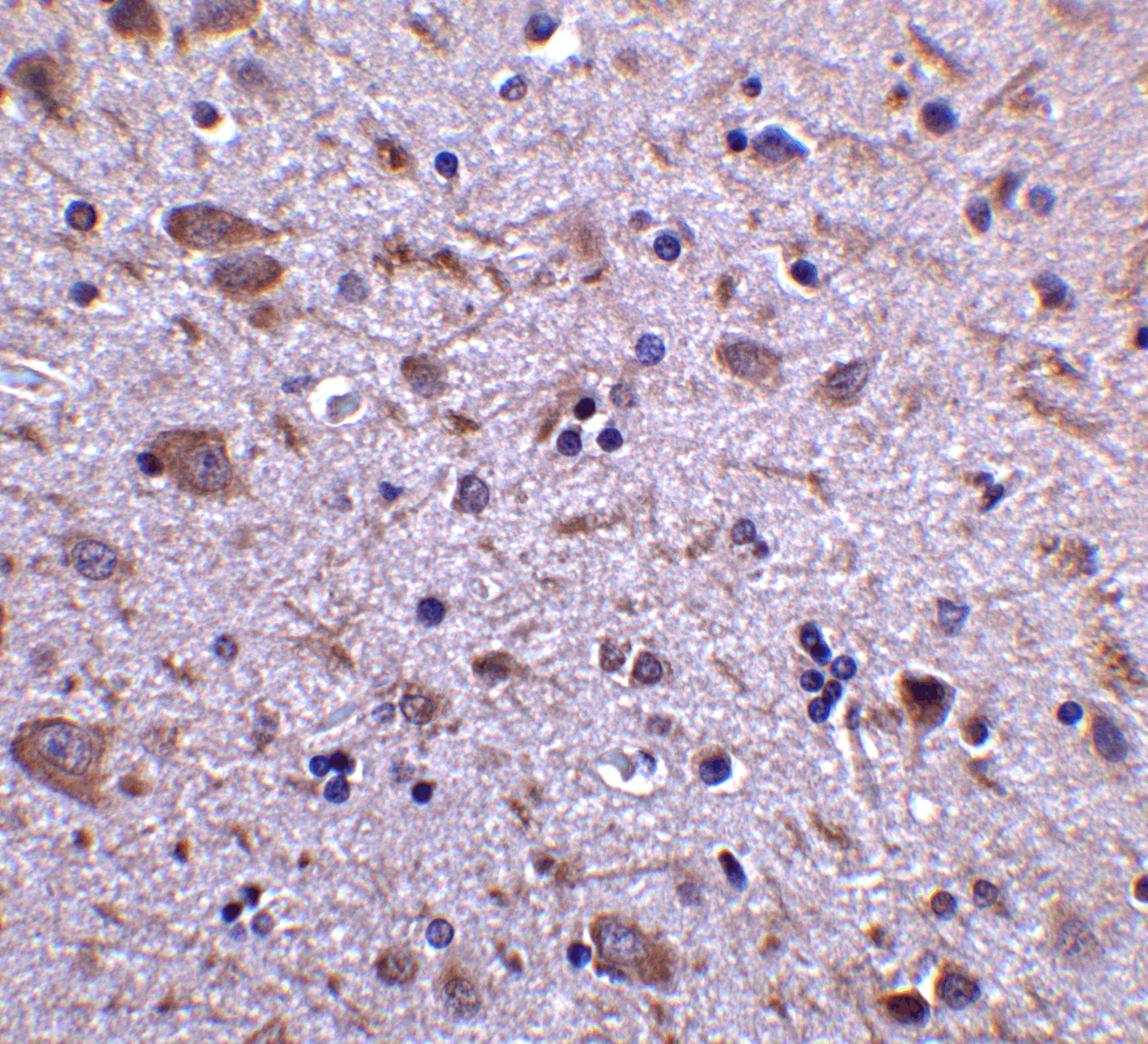 IRGM Antibody - BSA Free