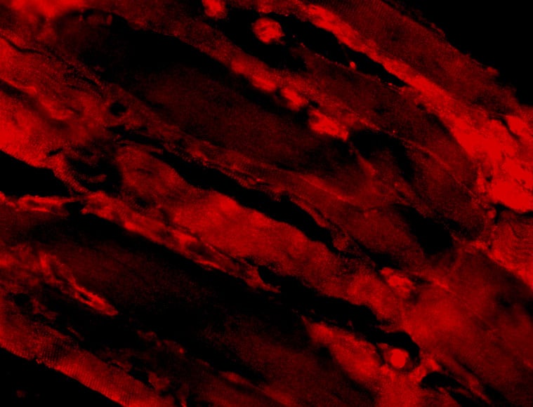 IL-31 Antibody - BSA Free