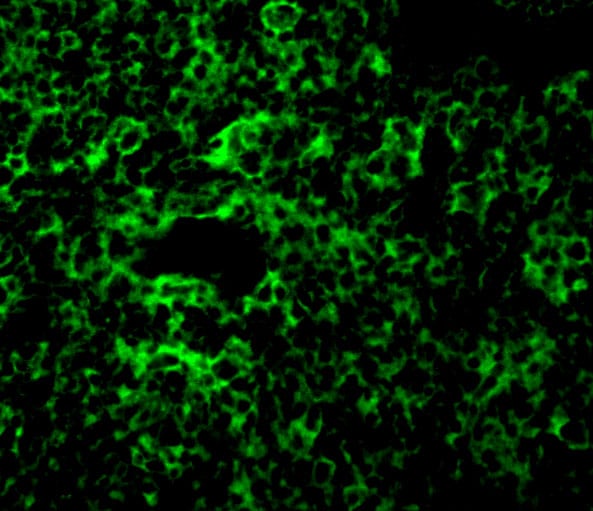 TAK1 Antibody - BSA Free