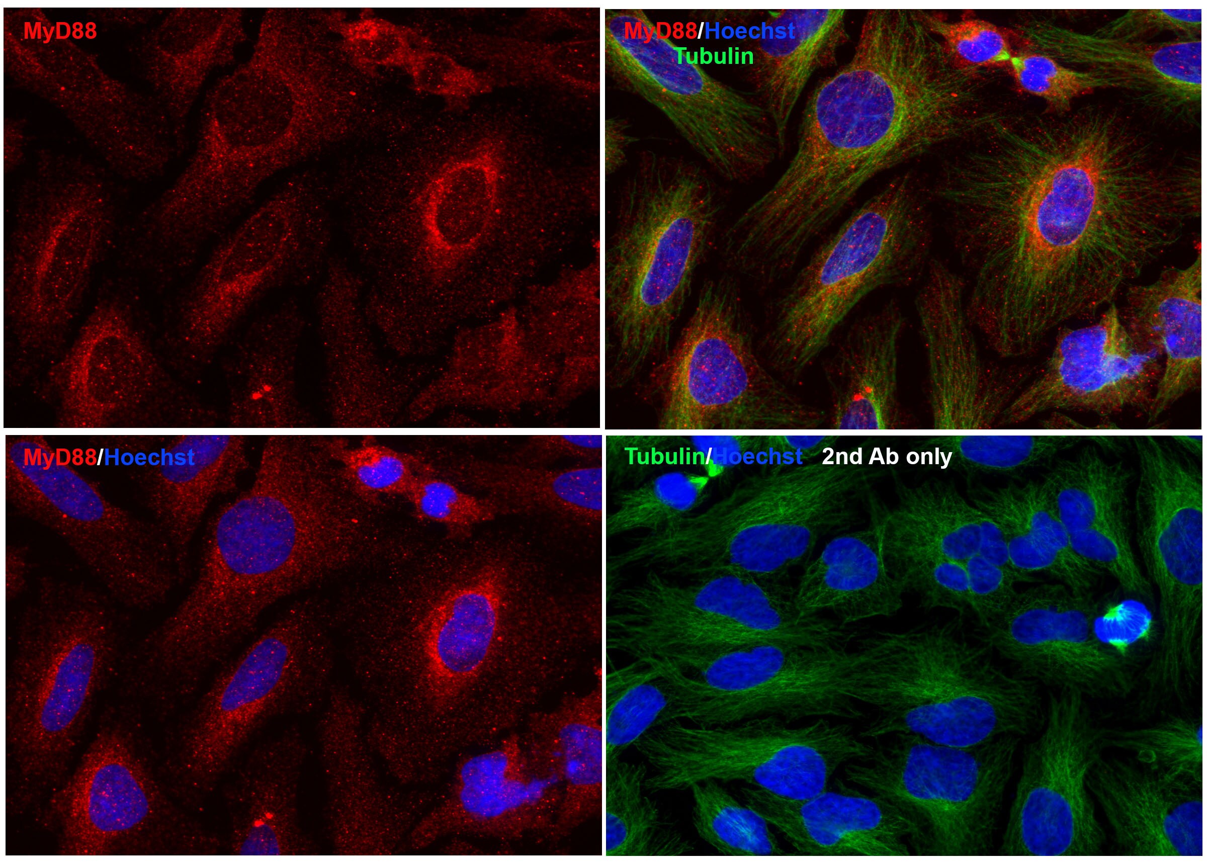 MyD88 Antibody - BSA Free