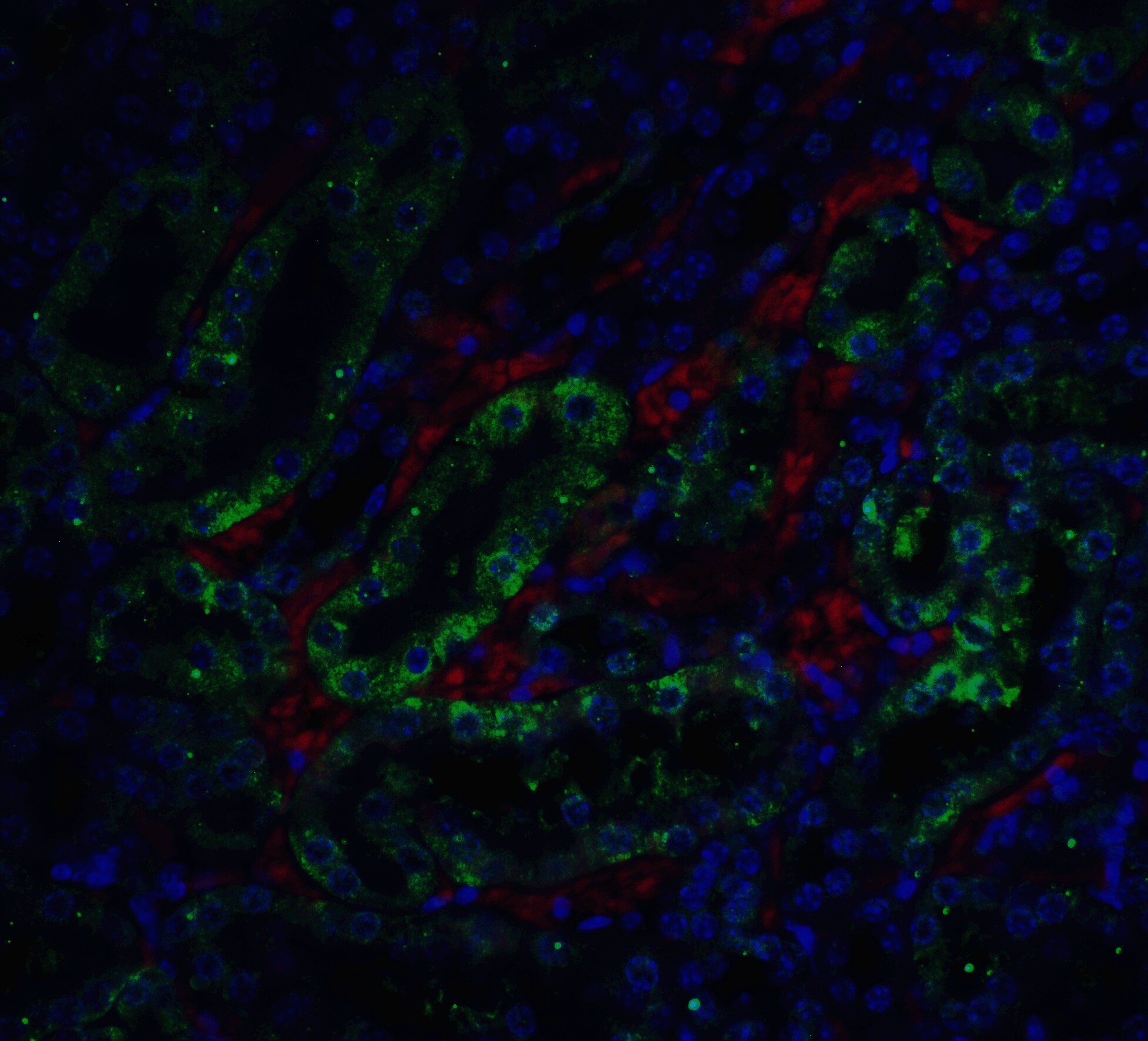 DFF45/ICAD Antibody - BSA Free