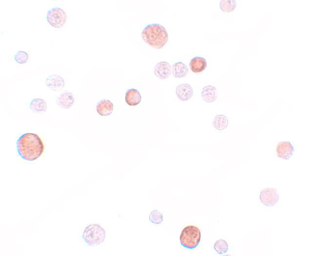 PLAC1 Antibody - BSA Free