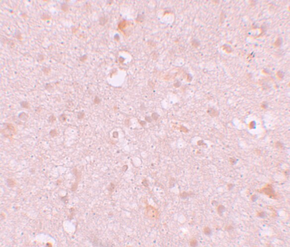CXXC4 Antibody - BSA Free
