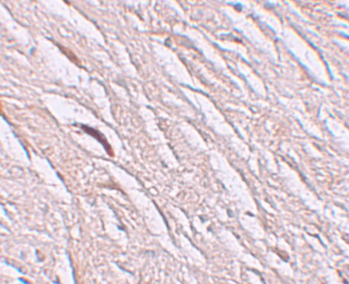 SLC39A2/ZIP2 Antibody - BSA Free