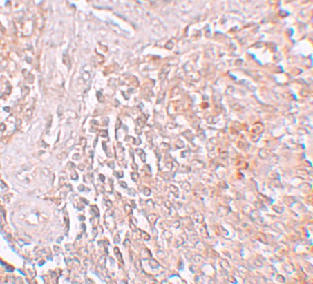 SLC39A8/ZIP8 Antibody - BSA Free