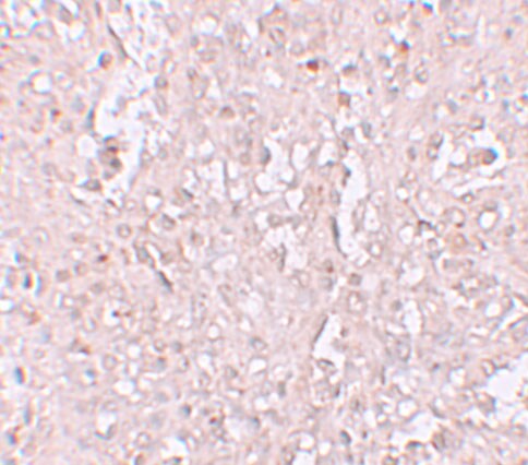 SLC39A13 Antibody - BSA Free