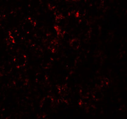 SLC39A14 Antibody - BSA Free