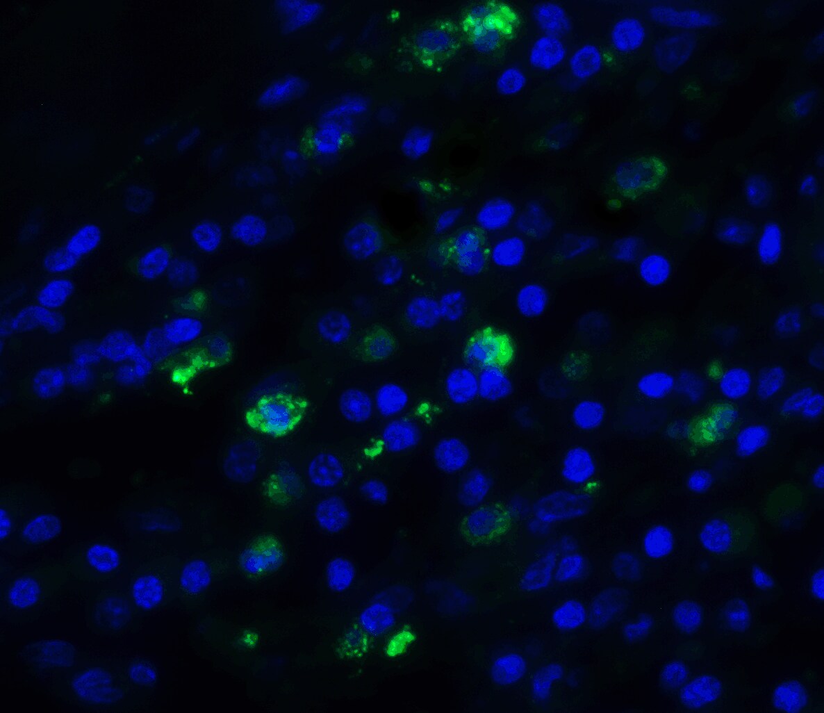 TFF3 Antibody - BSA Free