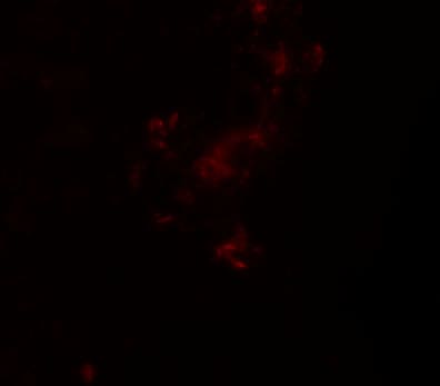ZBTB5 Antibody - BSA Free