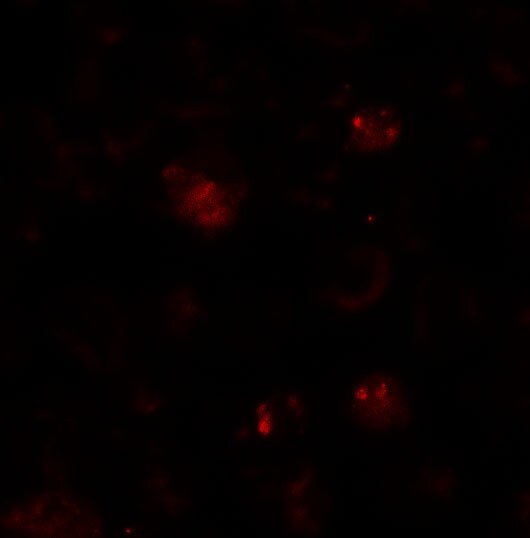 ZBTB6 Antibody - BSA Free