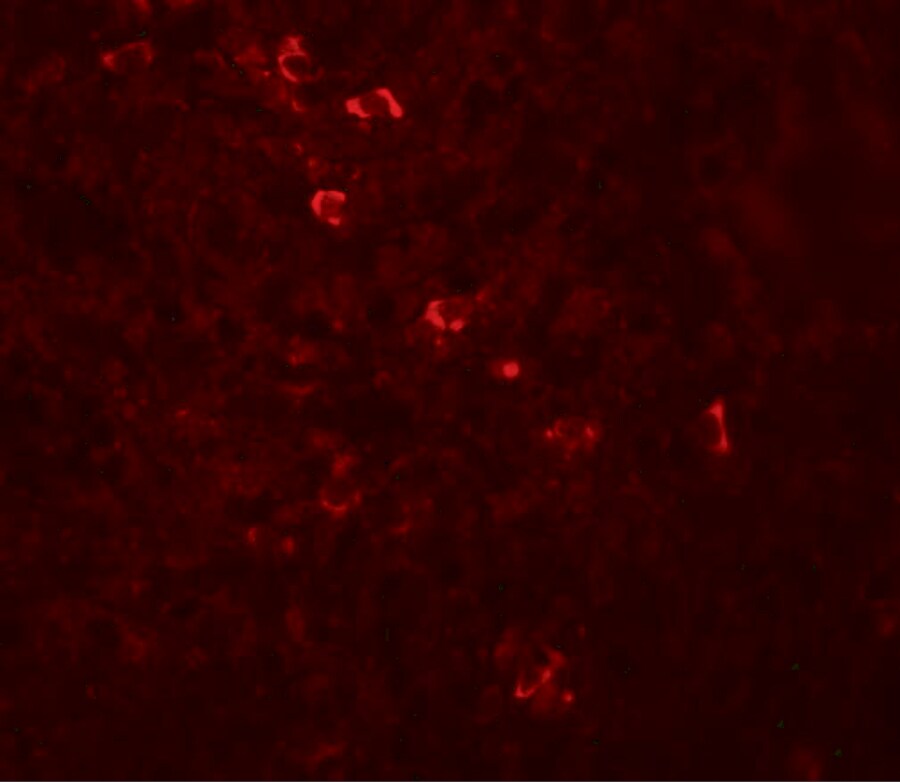 ZBTB8A Antibody - BSA Free