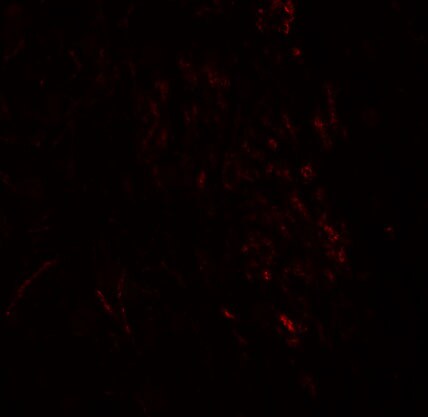 ZMYM3 Antibody - BSA Free