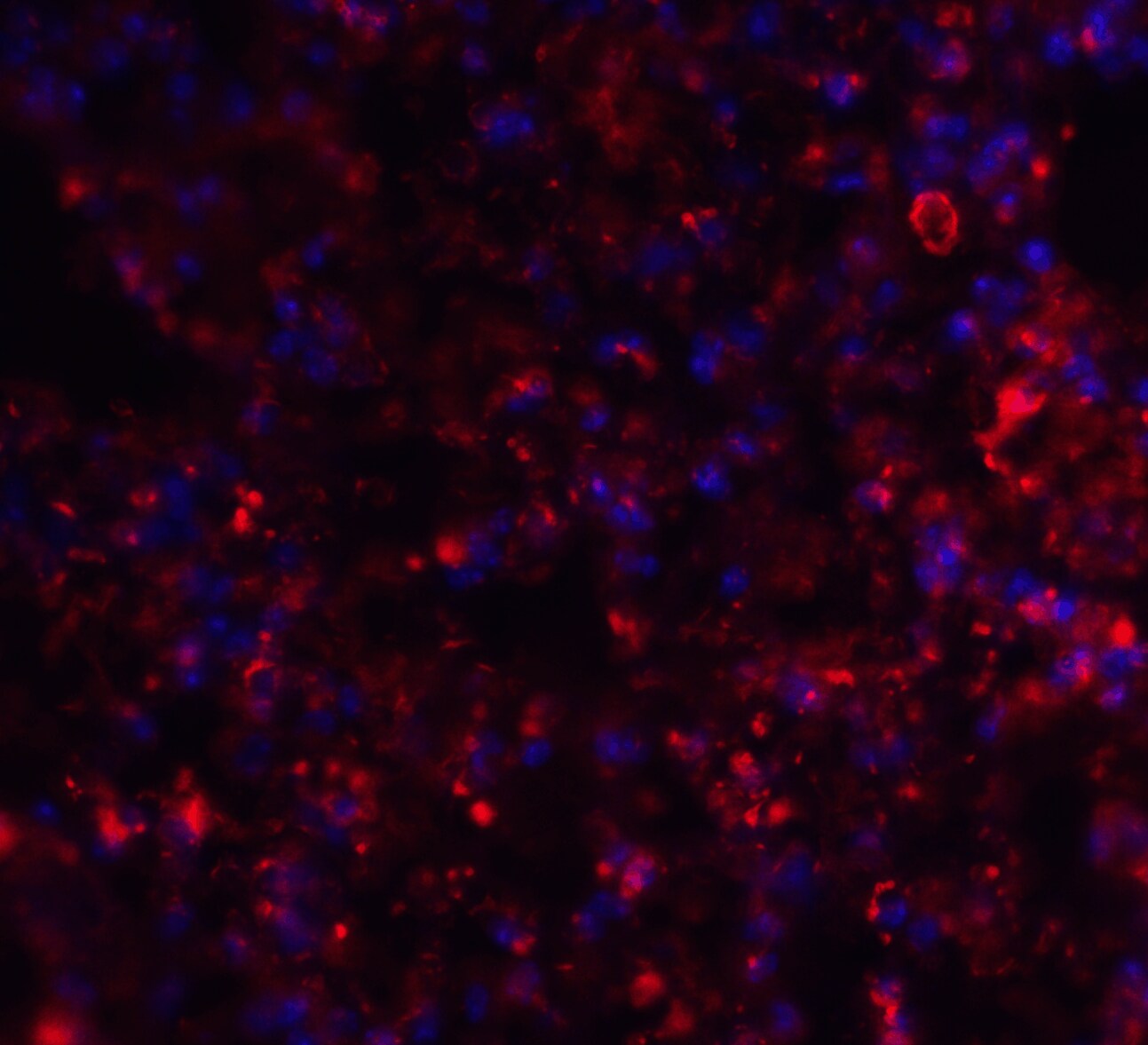 Axin-2 Antibody - BSA Free