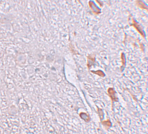LRRTM1 Antibody - BSA Free