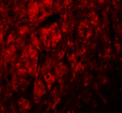 LRRTM3 Antibody - BSA Free