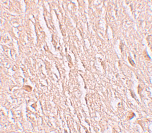 LRRTM3 Antibody - BSA Free