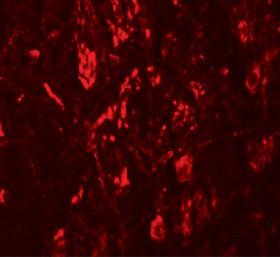 LRRTM4 Antibody - BSA Free
