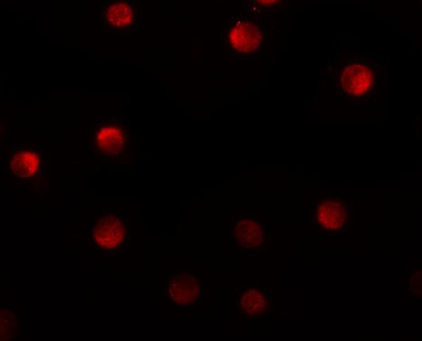 N4BP1 Antibody - BSA Free