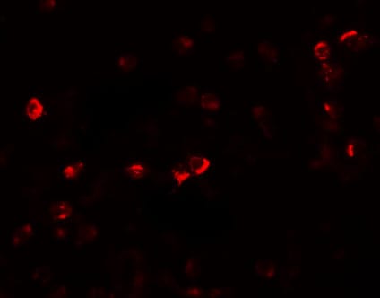 OGFOD1 Antibody - BSA Free