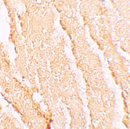 VPS39 Antibody - BSA Free