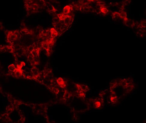 ESRP2 Antibody - BSA Free