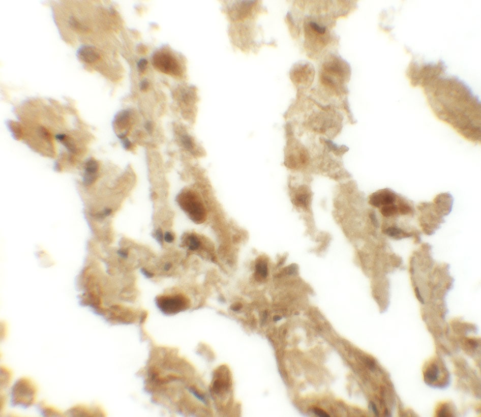 ESRP2 Antibody - BSA Free