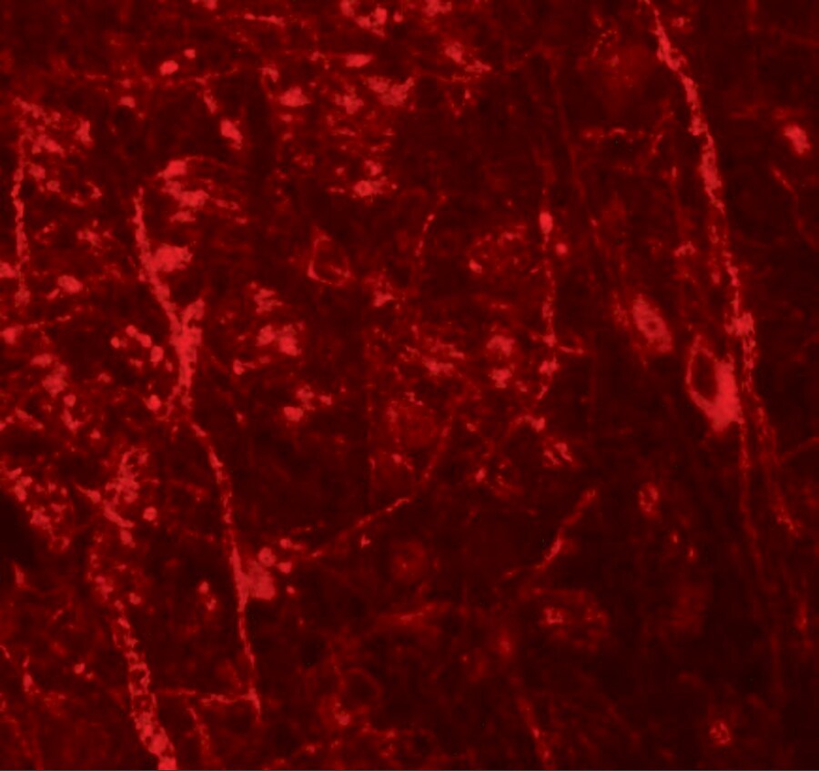NKX3-2 Antibody - BSA Free