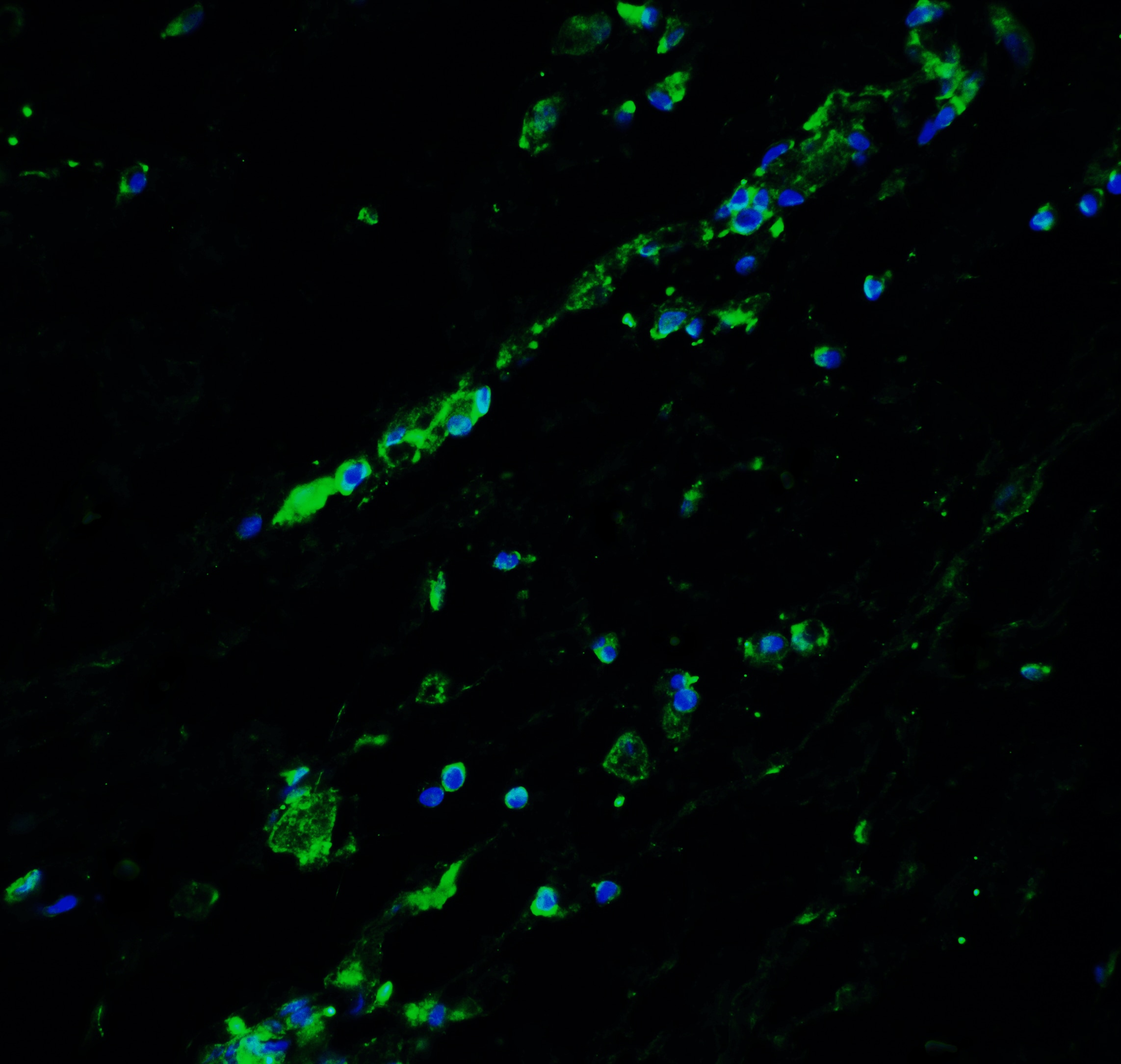 BCL9-2 Antibody - BSA Free