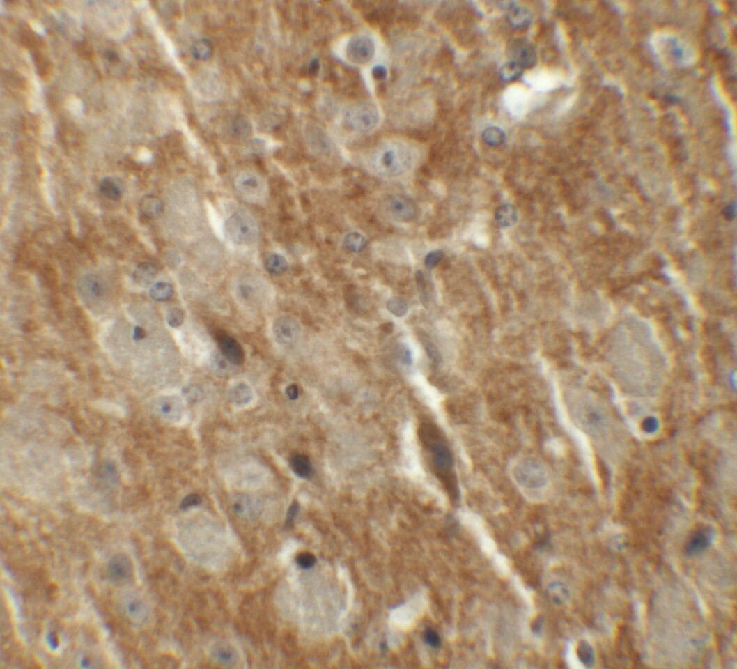 CTNNBL1 Antibody - BSA Free