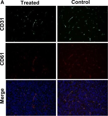 GLS2 Antibody - BSA Free