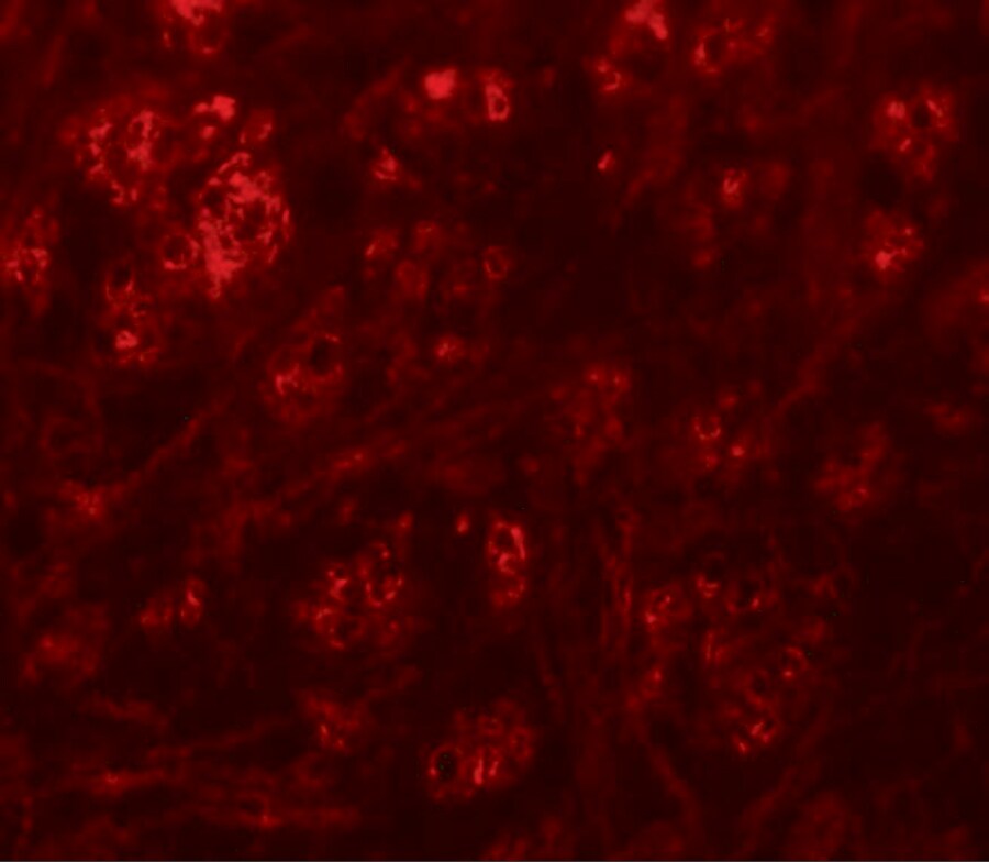 Rabex5 Antibody - BSA Free