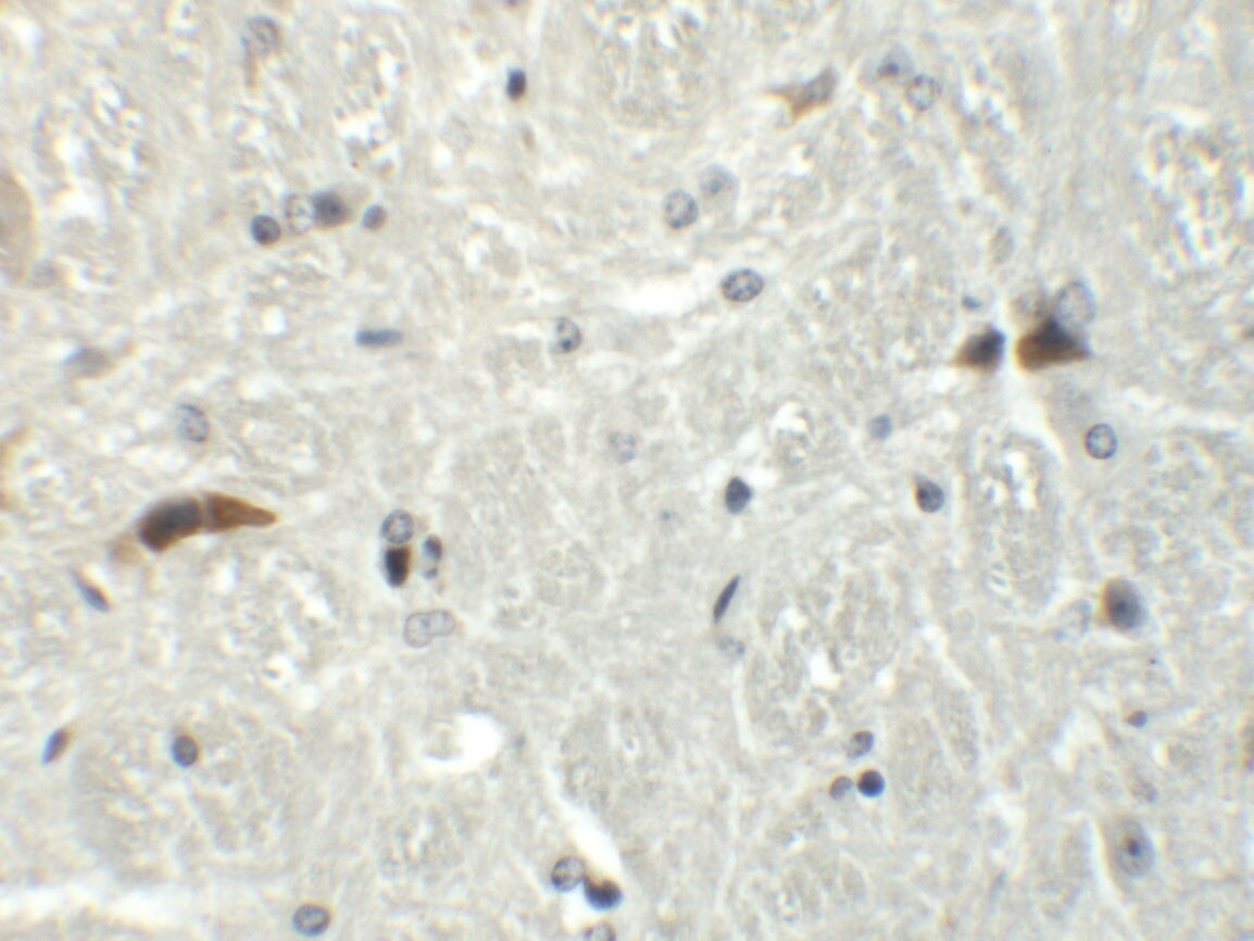 Rabex5 Antibody - BSA Free