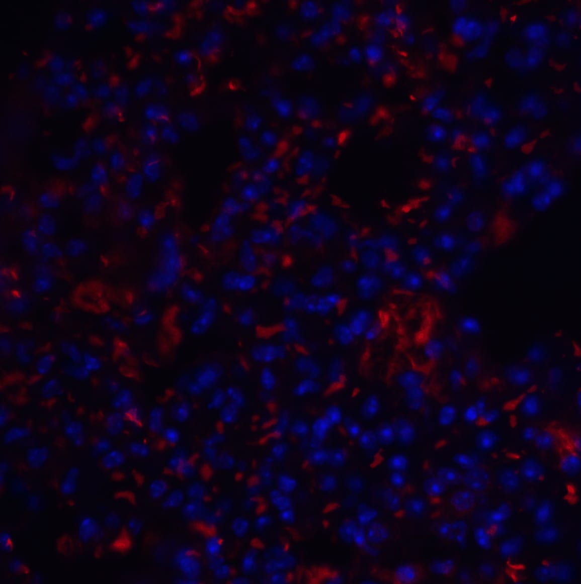 TM4SF1/L6 Antibody - BSA Free
