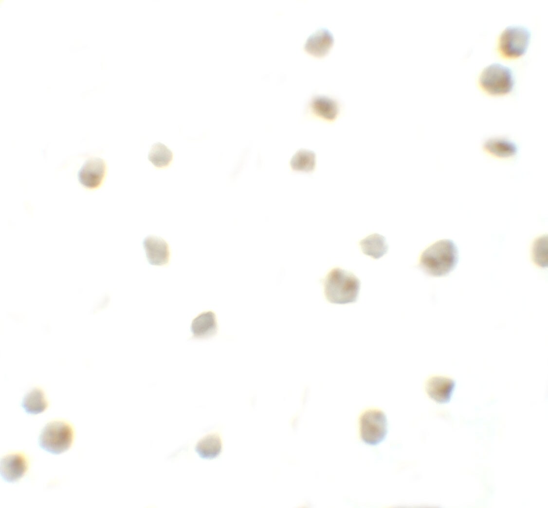 DYRK2 Antibody - BSA Free