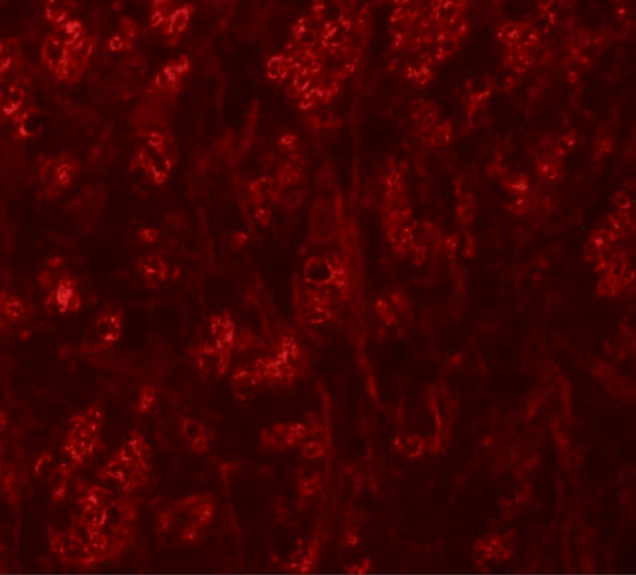 ATP2C1 Antibody - BSA Free