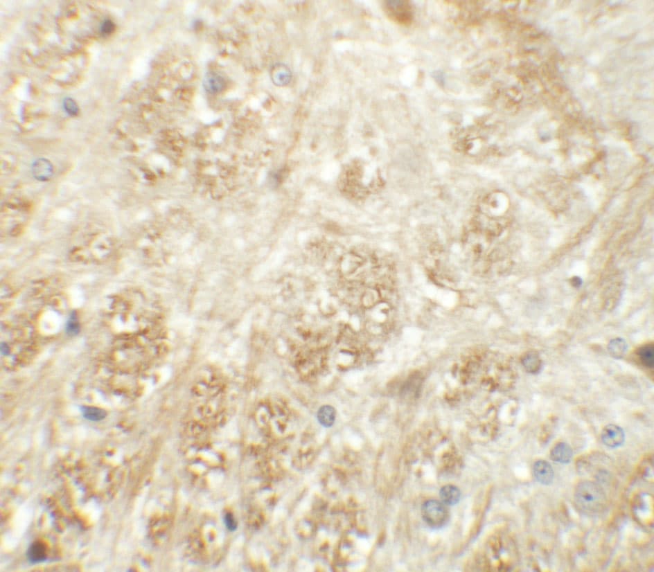 ATP2C1 Antibody - BSA Free