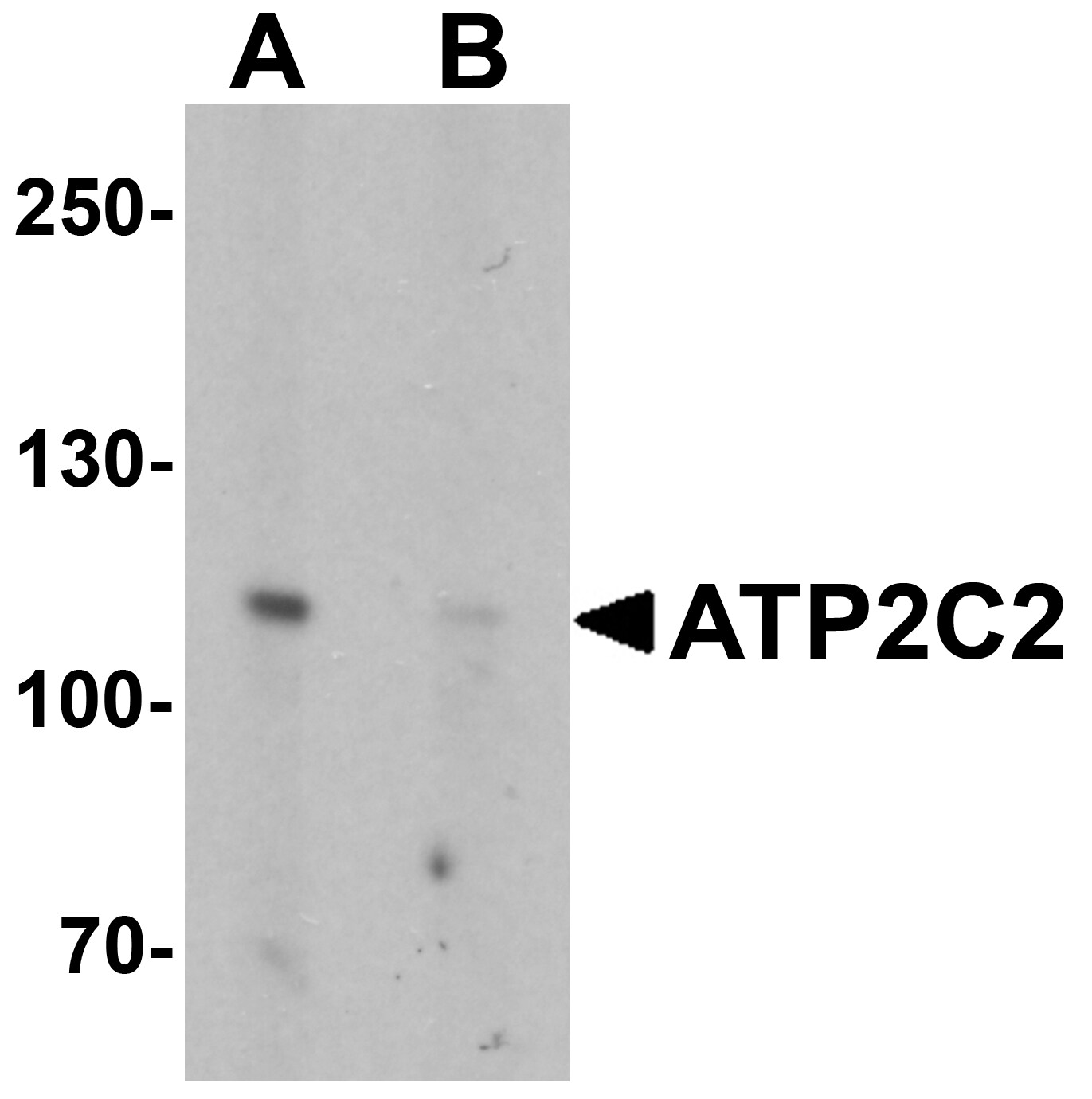 ATP2C2 Antibody Blocking Peptide