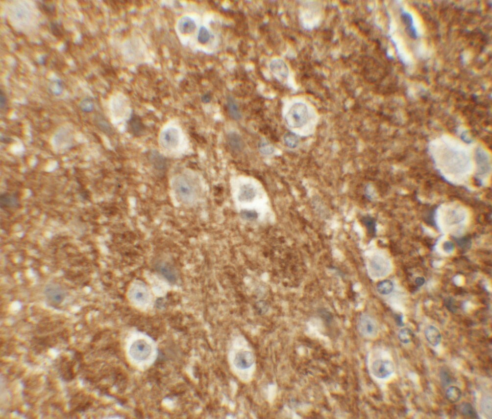 ROCK2 Antibody - BSA Free