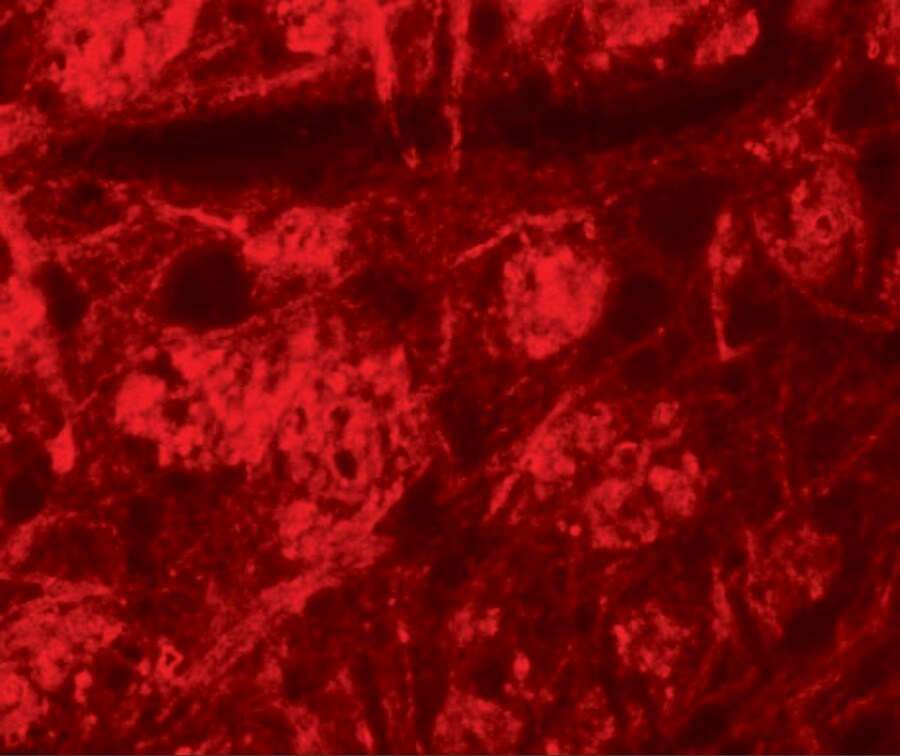 ROCK2 Antibody - BSA Free