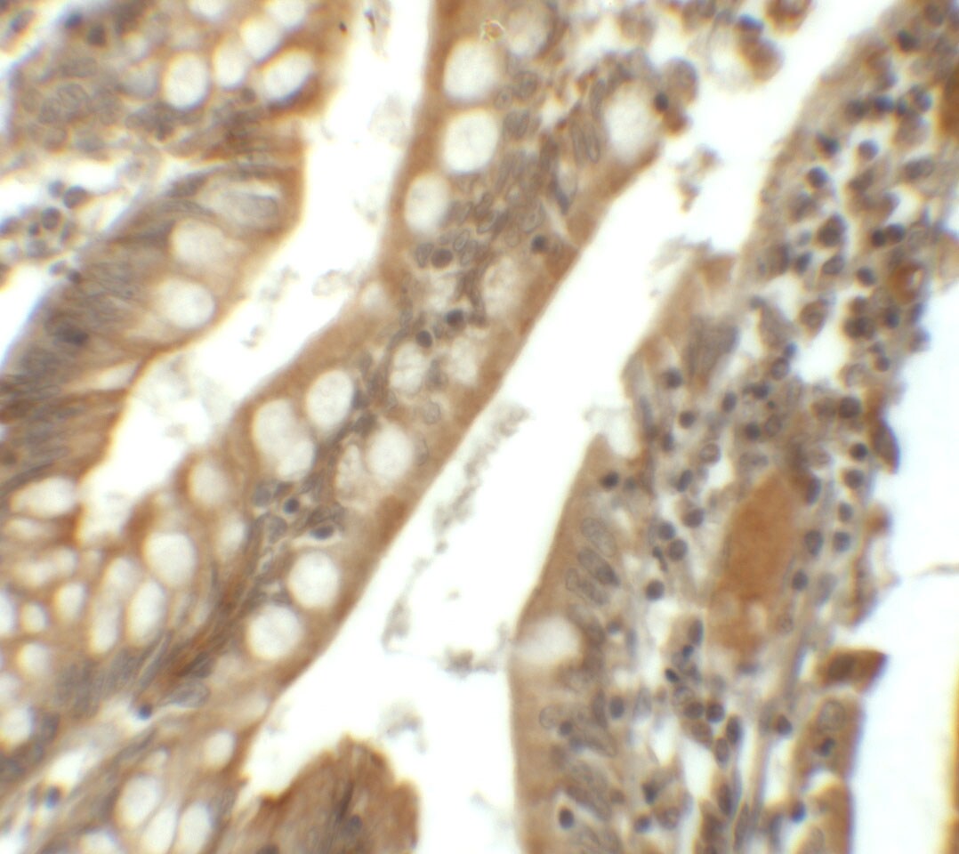 SIK1/Snf1lk Antibody - BSA Free