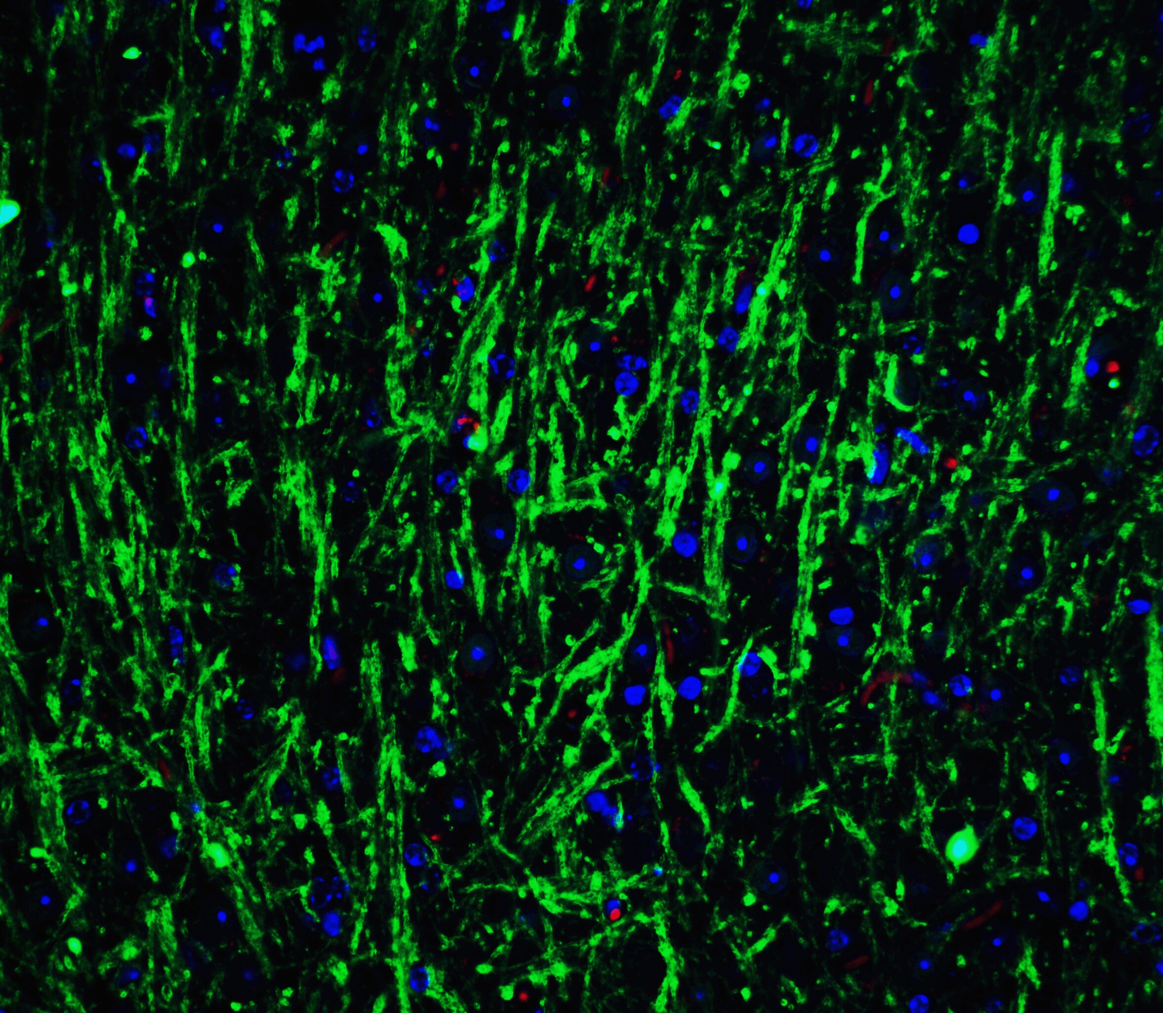 Musashi-2 Antibody - BSA Free