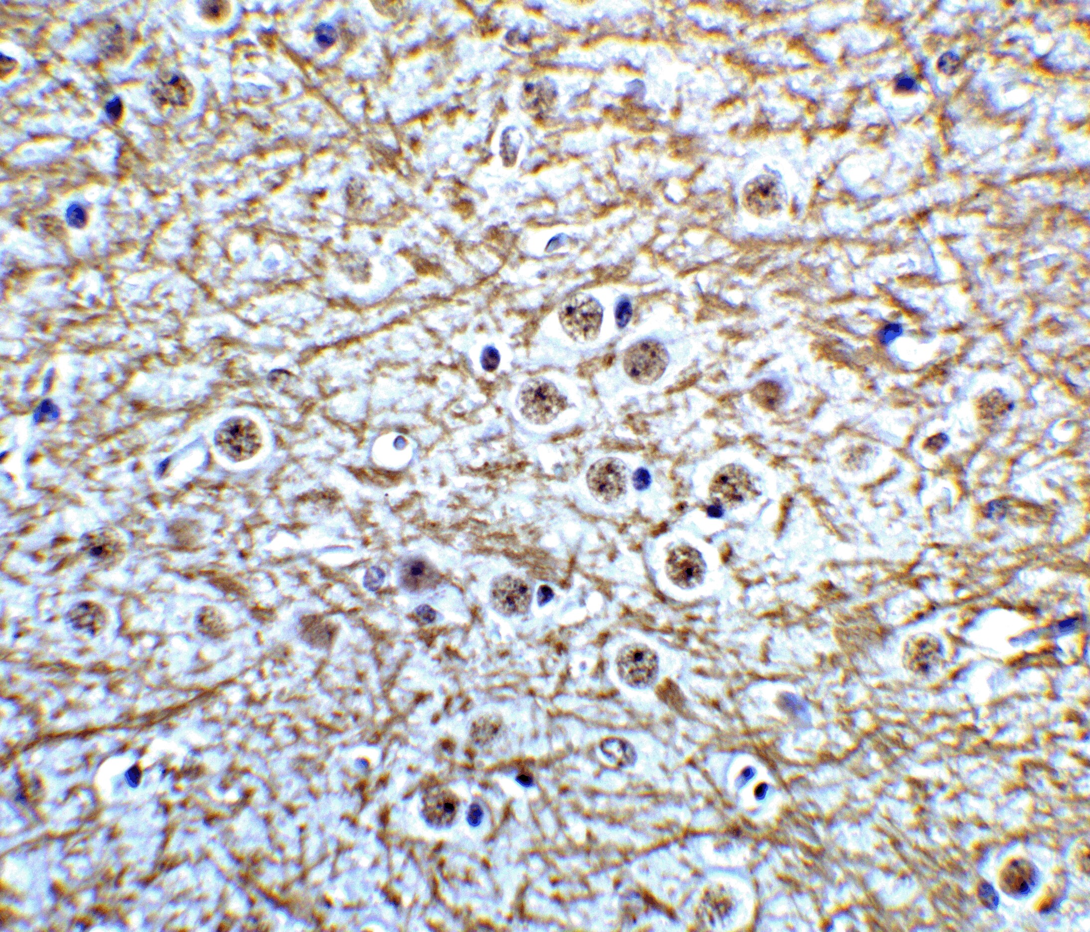 Musashi-2 Antibody - BSA Free