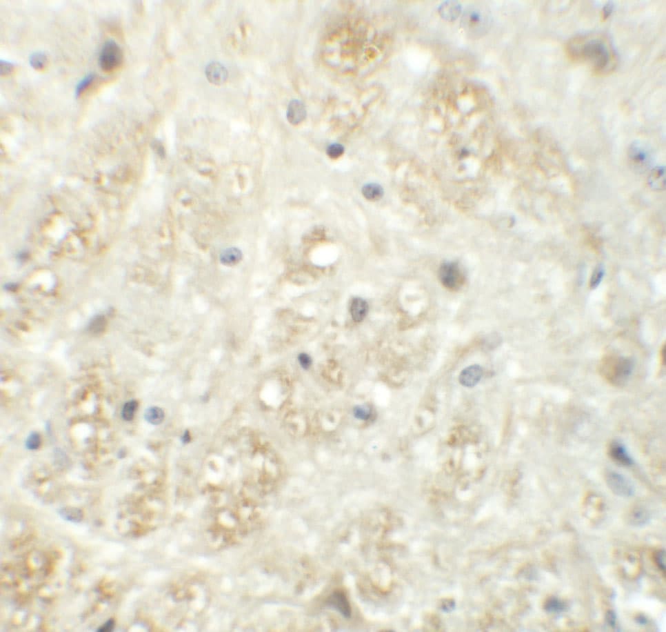 Vasohibin Antibody - BSA Free