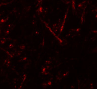Vasohibin Antibody - BSA Free