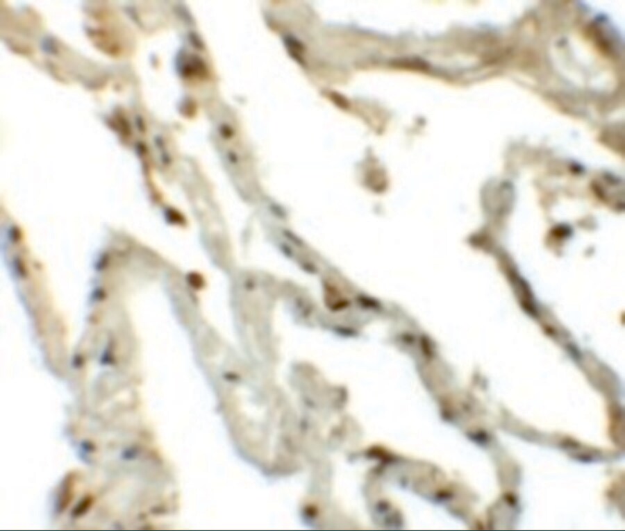 Translin Antibody - BSA Free