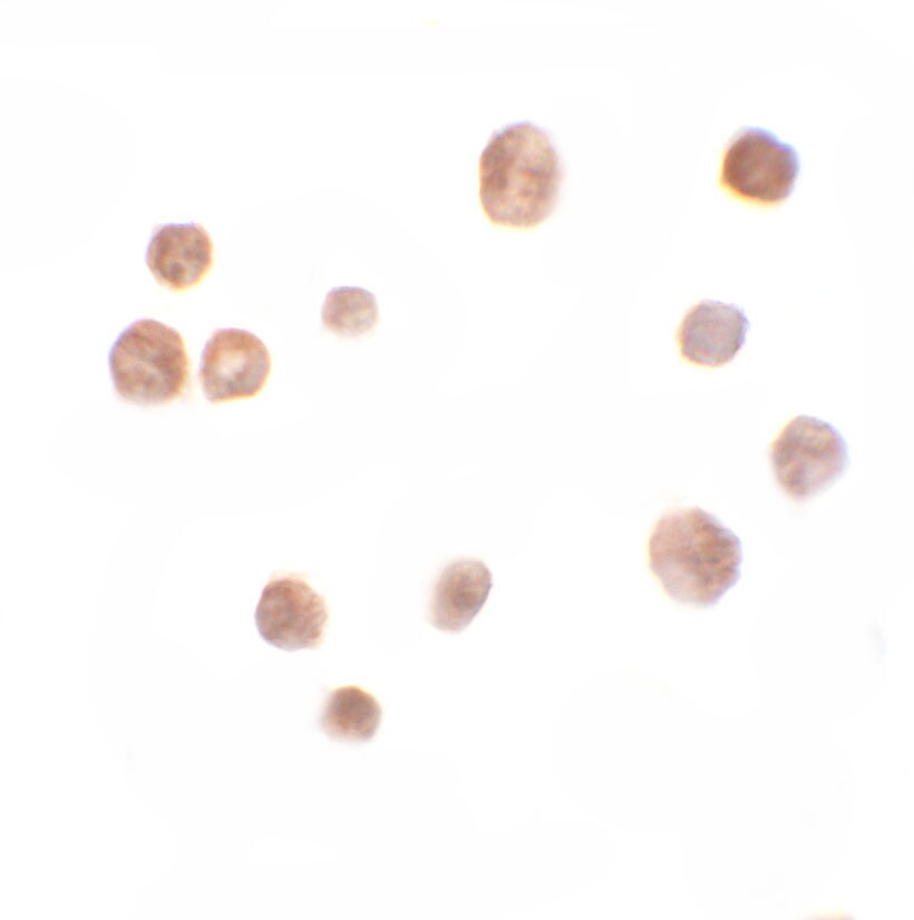 TRMT12 Antibody - BSA Free