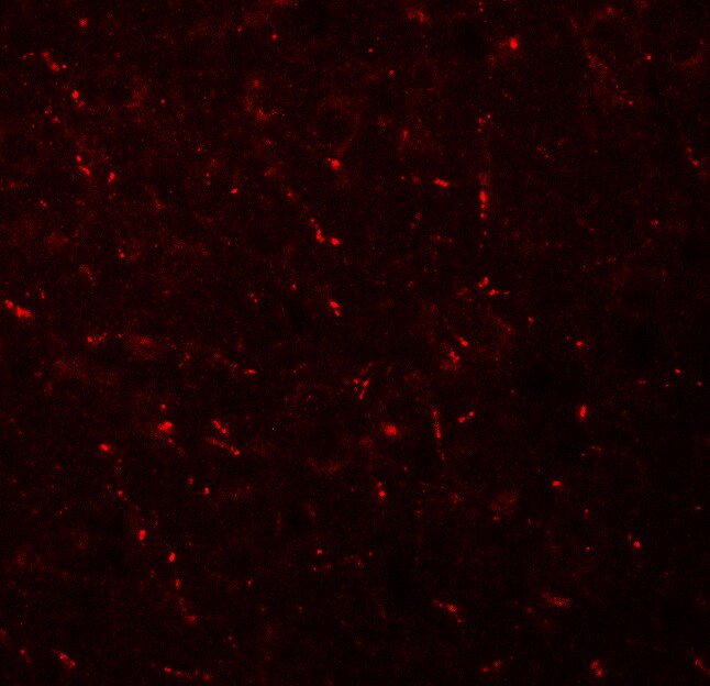 AP3M1 Antibody - BSA Free